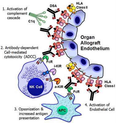 The Impact of HLA Class I-Specific Killer Cell Immunoglobulin-Like Receptors on Antibody-Dependent Natural Killer Cell-Mediated Cytotoxicity and Organ Allograft Rejection